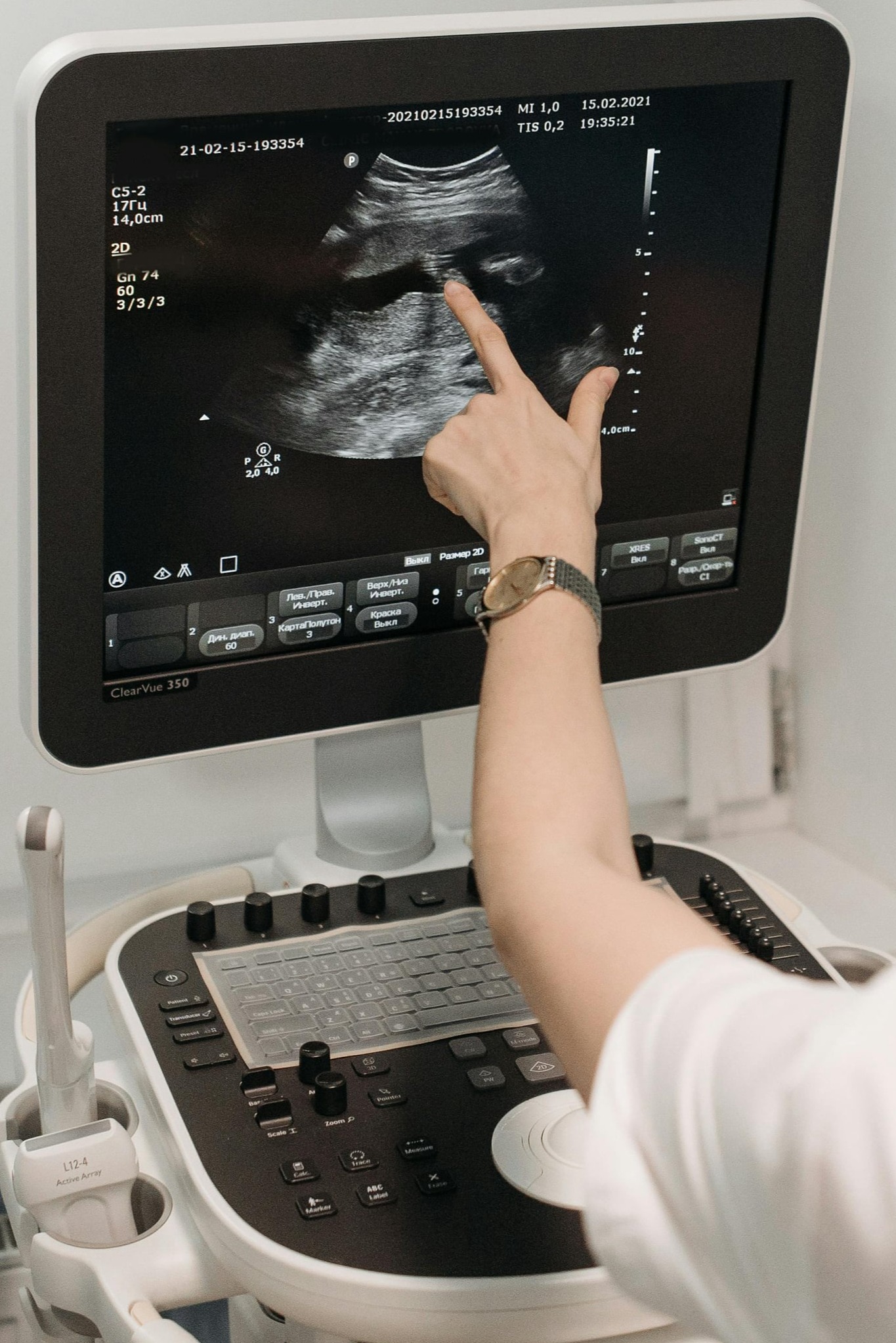 Ultrasound
